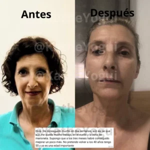 testimonio2-yoga-facial